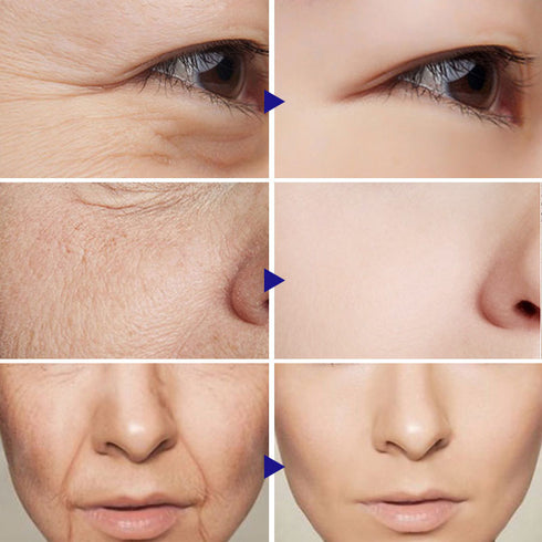 Vitamin C Serum Facial Serum Amazon - ROUTINE FASHION